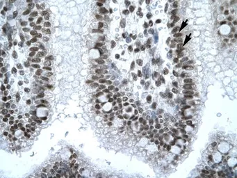 Anti-IRF8 antibody, N-term used in IHC (Paraffin sections) (IHC-P). GTX77895