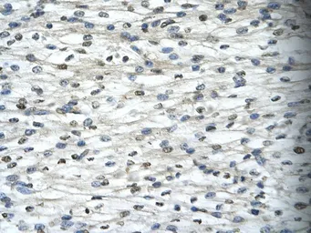 Anti-TAF15 antibody, N-term used in IHC (Paraffin sections) (IHC-P). GTX77901