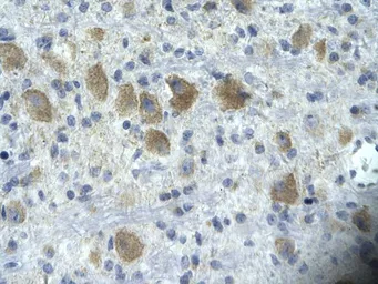 Anti-TAF15 antibody, N-term used in IHC (Paraffin sections) (IHC-P). GTX77901