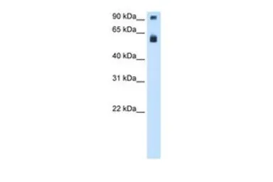 Anti-TAF15 antibody, N-term used in Western Blot (WB). GTX77901