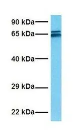 Anti-TAF15 antibody, N-term used in Western Blot (WB). GTX77901