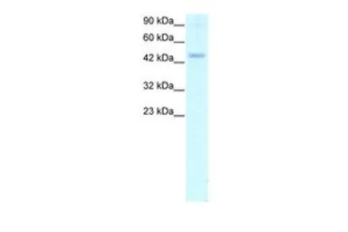 Anti-Calreticulin antibody, C-term used in Western Blot (WB). GTX77902