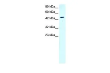 Anti-GATA2 antibody, N-term used in Western Blot (WB). GTX77904