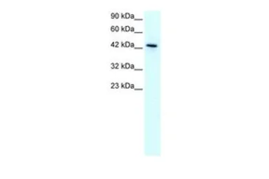 Anti-KLF15 antibody, N-term used in Western Blot (WB). GTX77907