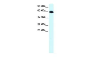 Anti-ThPok antibody, Internal used in Western Blot (WB). GTX77909