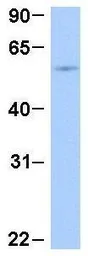 Anti-ThPok antibody, Internal used in Western Blot (WB). GTX77909