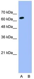 Anti-ThPok antibody, Internal used in Western Blot (WB). GTX77909