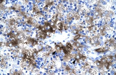 Anti-PIAS3 antibody, C-term used in IHC (Paraffin sections) (IHC-P). GTX77910