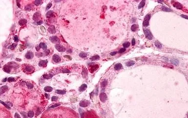 Anti-GPR56 antibody used in IHC (Paraffin sections) (IHC-P). GTX77957