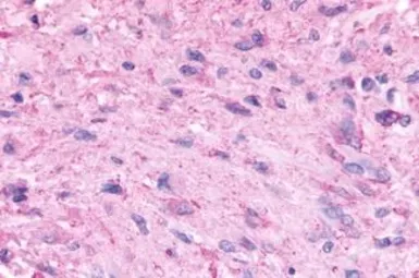 Anti-5-HT5A receptor antibody used in IHC (Paraffin sections) (IHC-P). GTX77999