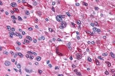 Anti-AVPR1B antibody used in IHC (Paraffin sections) (IHC-P). GTX78015
