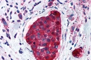 Anti-GPRC5A antibody used in IHC (Paraffin sections) (IHC-P). GTX78047