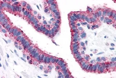Anti-GPRC5A antibody used in IHC (Paraffin sections) (IHC-P). GTX78047