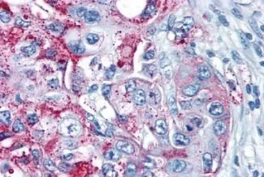 Anti-GPRC5A antibody used in IHC (Paraffin sections) (IHC-P). GTX78047
