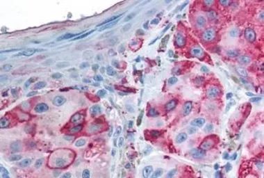 Anti-GPRC5A antibody used in IHC (Paraffin sections) (IHC-P). GTX78047