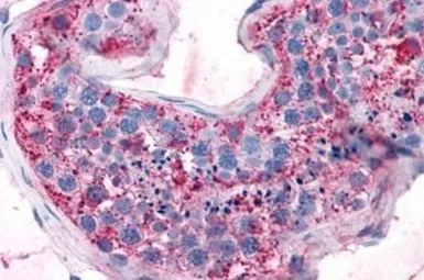 Anti-GPRC5A antibody used in IHC (Paraffin sections) (IHC-P). GTX78047