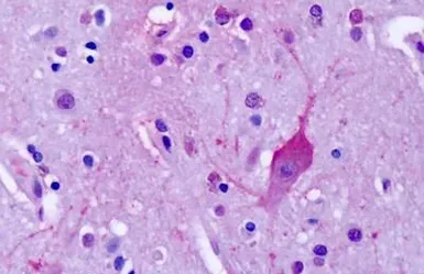 Anti-mGluR4 antibody used in IHC (Paraffin sections) (IHC-P). GTX78079