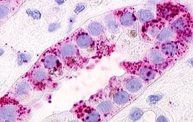 Anti-GPRC5D antibody used in IHC (Paraffin sections) (IHC-P). GTX78097
