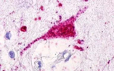 Anti-GPRC5D antibody used in IHC (Paraffin sections) (IHC-P). GTX78097