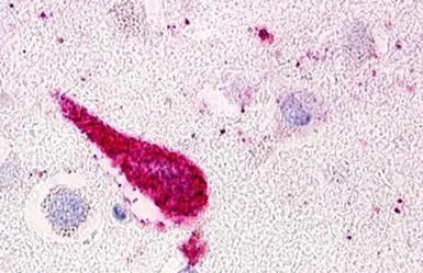 Anti-GPRC5D antibody used in IHC (Paraffin sections) (IHC-P). GTX78097