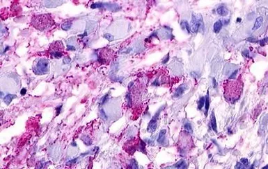 Anti-GPRC5D antibody used in IHC (Paraffin sections) (IHC-P). GTX78097