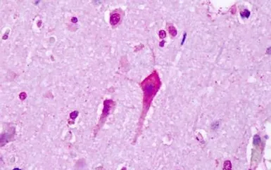 Anti-5-HT7 receptor antibody used in IHC (Paraffin sections) (IHC-P). GTX78121