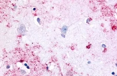 Anti-PAK6 antibody used in IHC (Paraffin sections) (IHC-P). GTX78127
