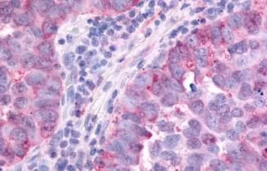 Anti-PAK6 antibody used in IHC (Paraffin sections) (IHC-P). GTX78127