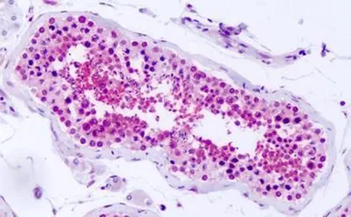 Anti-PKD2 antibody used in IHC (Paraffin sections) (IHC-P). GTX78137