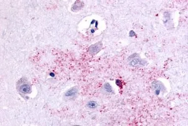 Anti-PAK6 antibody used in IHC (Paraffin sections) (IHC-P). GTX78145