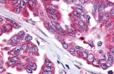 Anti-CDC7 antibody used in IHC (Paraffin sections) (IHC-P). GTX78149