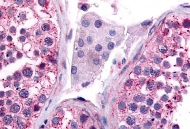 Anti-CDC7 antibody used in IHC (Paraffin sections) (IHC-P). GTX78149