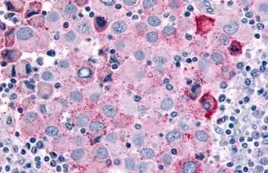 Anti-CDC7 antibody used in IHC (Paraffin sections) (IHC-P). GTX78151
