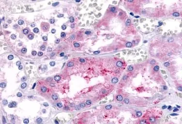 Anti-Prostaglandin E Receptor EP1 antibody used in IHC (Paraffin sections) (IHC-P). GTX78161