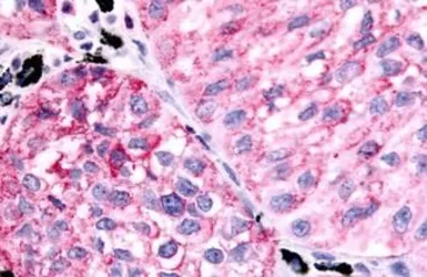 Anti-Prostaglandin E Receptor EP1 antibody used in IHC (Paraffin sections) (IHC-P). GTX78161