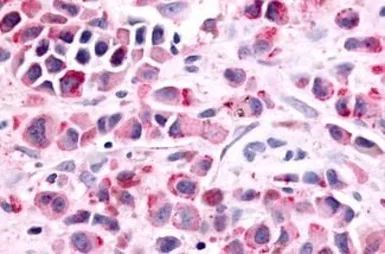 Anti-Prostaglandin E Receptor EP1 antibody used in IHC (Paraffin sections) (IHC-P). GTX78161