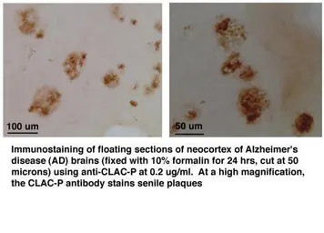 Anti-CLACP antibody used in Immunohistochemistry (IHC). GTX78175