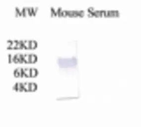 Anti-C3 / C3a antibody used in Western Blot (WB). GTX78199