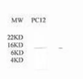 Anti-Cytochrome C antibody used in Western Blot (WB). GTX78200