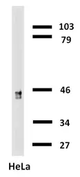 Anti-Cytokeratin 18 antibody [C-04] (Biotin) used in Western Blot (WB). GTX78237