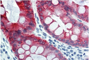 Anti-Cytokeratin 18 antibody [DC-10] used in IHC (Paraffin sections) (IHC-P). GTX78238