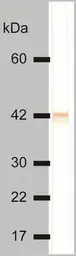 Anti-Cytokeratin 18 antibody [DC-10] used in Western Blot (WB). GTX78238