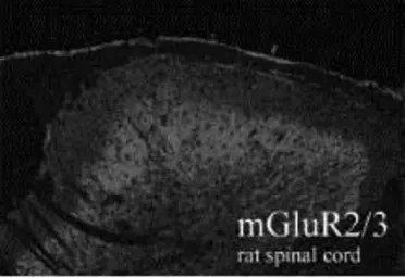 Anti-mGluR2 + mGluR3 antibody used in Immunohistochemistry (IHC). GTX78272