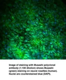Anti-Musashi 1 antibody used in Immunocytochemistry/ Immunofluorescence (ICC/IF). GTX78273