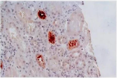 Anti-HLA-G antibody [MEM-G/2] used in IHC (Paraffin sections) (IHC-P). GTX78394