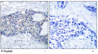 Anti-ZAP70 (phospho Tyr493) antibody used in IHC (Paraffin sections) (IHC-P). GTX78921