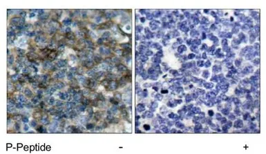 Anti-VASP (phospho Ser157) antibody used in IHC (Paraffin sections) (IHC-P). GTX78924