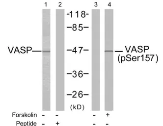 Anti-VASP (phospho Ser157) antibody used in Western Blot (WB). GTX78924