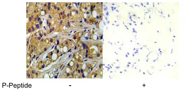 Anti-TSC2 (phospho Ser1254) antibody used in IHC (Paraffin sections) (IHC-P). GTX78927
