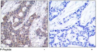 Anti-Stathmin 1 (phospho Ser16) antibody used in IHC (Paraffin sections) (IHC-P). GTX78934